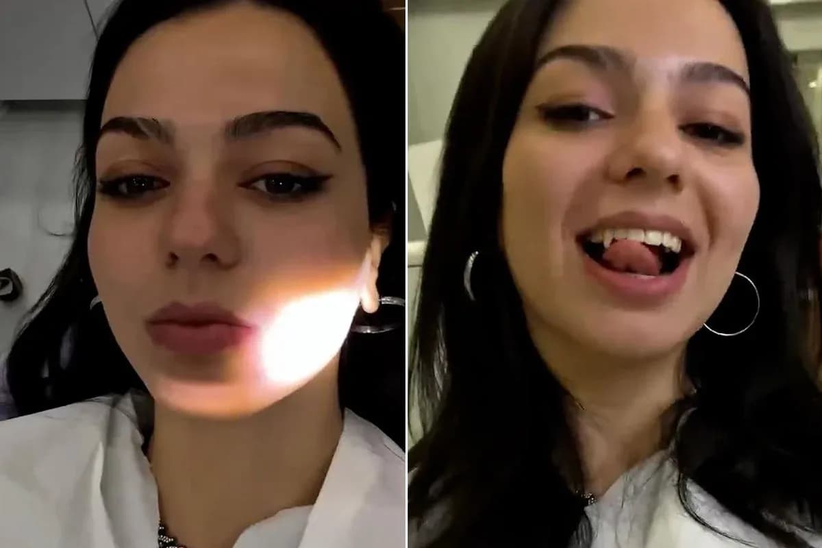 Yeni Estetik Trend: Vampir Dişi Operasyonu ve Detayları