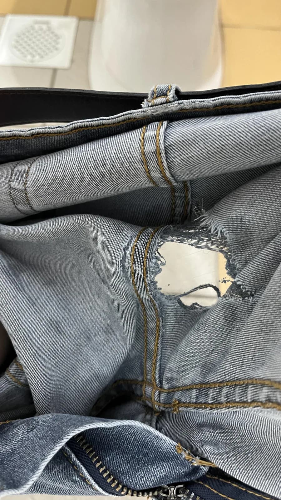 Pantolonunun En Kötü Yeri Yırtıldı